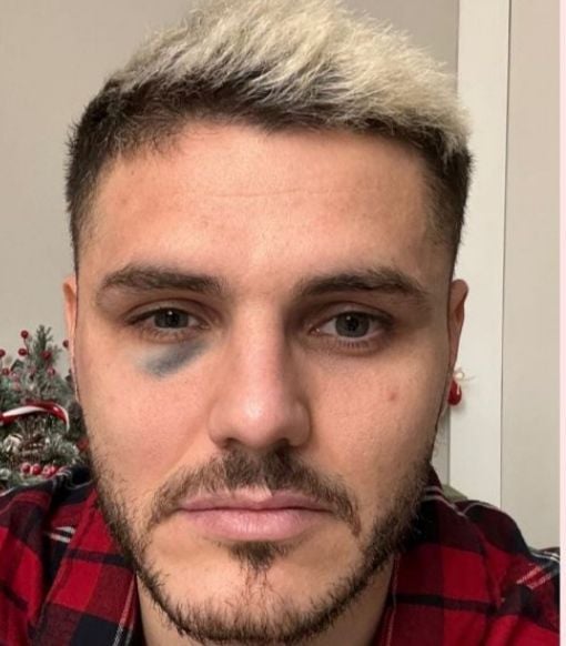 Mauro Icardi po meczu Fenerbahce - Galatasaray 😱